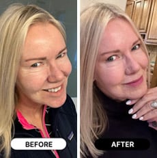 South Beach Collagen Filler Serum  reviews real